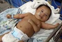 Китая удалят третью руку.jpg